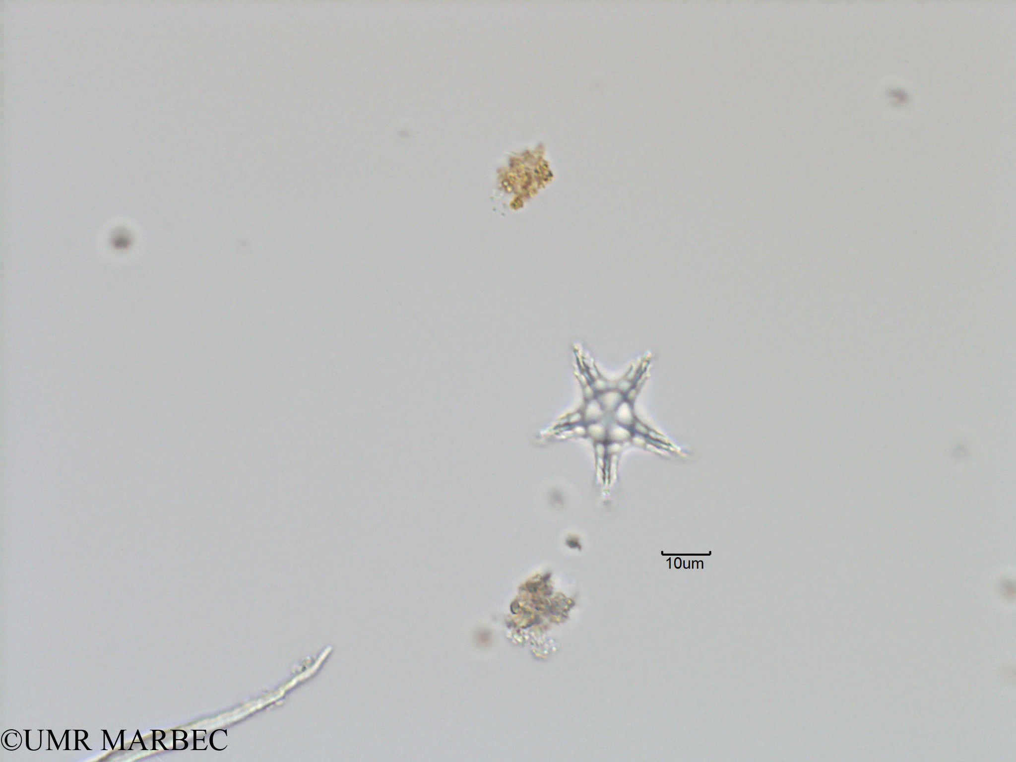 phyto/Bizerte/bizerte_bay/RISCO November 2015/Actiniscus pentasterias (Baie_T5-C1-Etoile-4).tif(copy).jpg